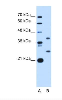 ST8SIA2 / STX Antibody (aa295-344)