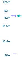 Human PPM1A / PP2CA Protein (Recombinant GST)
