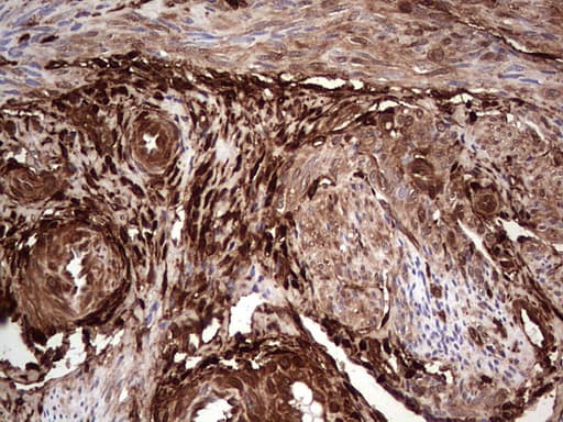 LGALS3 / Galectin 3 Antibody (clone OTI2F1)