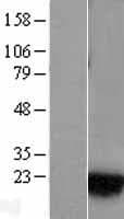 RAB1A Protein (Over-Expression Lysate Myc-DDK (Flag))