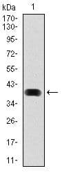 MAP1LC3B / LC3B Antibody (clone 5H12)
