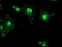 AIPL1 Antibody (clone OTI2D11)