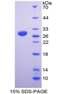 Human CD119 / IFNGR1 Protein (Recombinant His-T7)