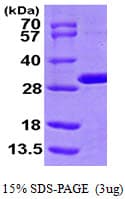 Human HsT19268 / MTHFS Protein (Recombinant His)