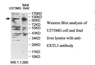 EXTL3 Antibody (aa750-919)