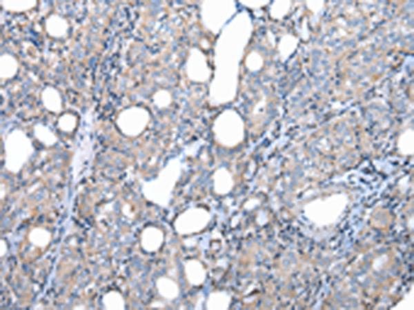 FKBPL Antibody