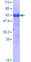 Human CAPG Protein (Recombinant GST)