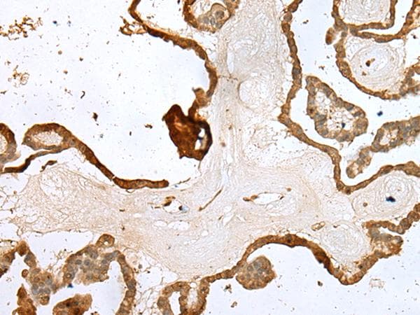 Polyclonal Rabbit anti-Human UBE2Z / USE1 Antibody (IHC, WB)