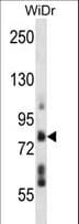 Polyclonal Rabbit anti-Human TMTC4 Antibody (aa175-204, WB)