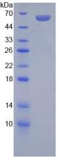 Human Mineralocorticoid Receptor Protein (Recombinant His-GST)