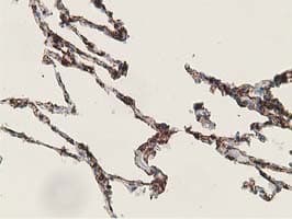 ADH2 / ADH1B Antibody (clone OTI1C3)