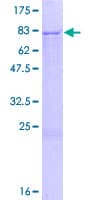 Human PMPCA Protein (Recombinant GST)