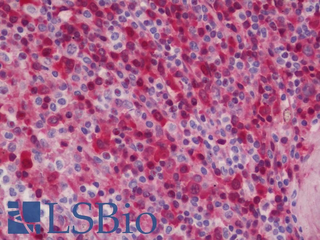 IHC-plus™ Polyclonal Rabbit anti-Human GJB1 / CX32 / Connexin 32 Antibody (aa66-115, IHC, WB)
