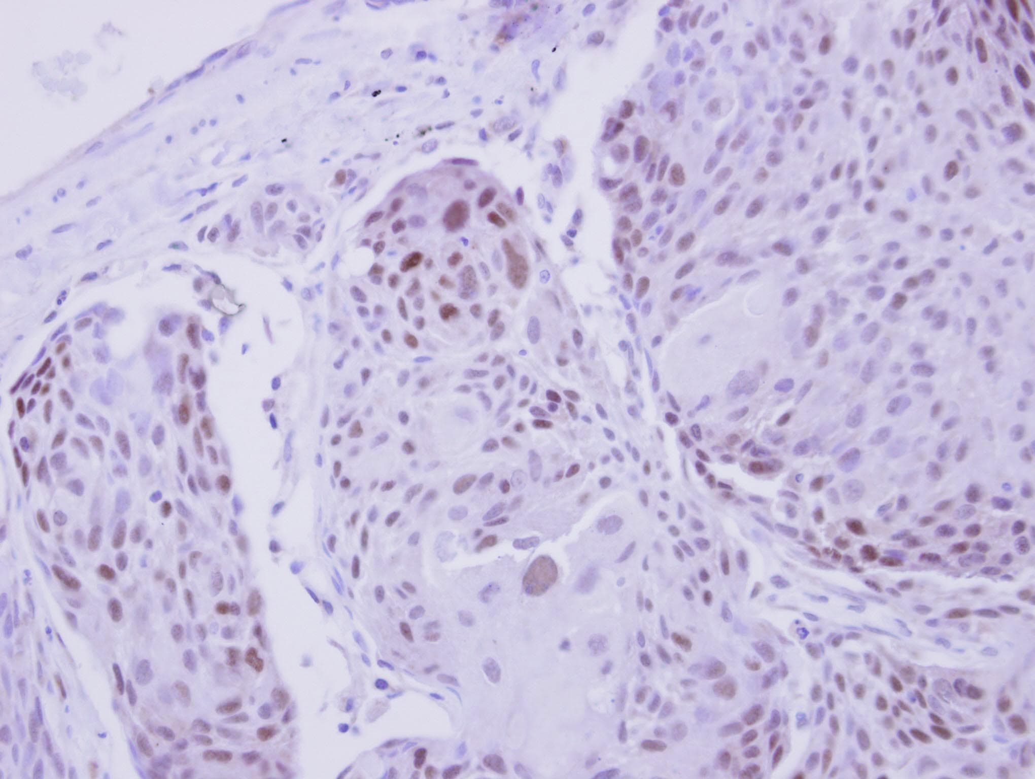 ZNF530 Antibody
