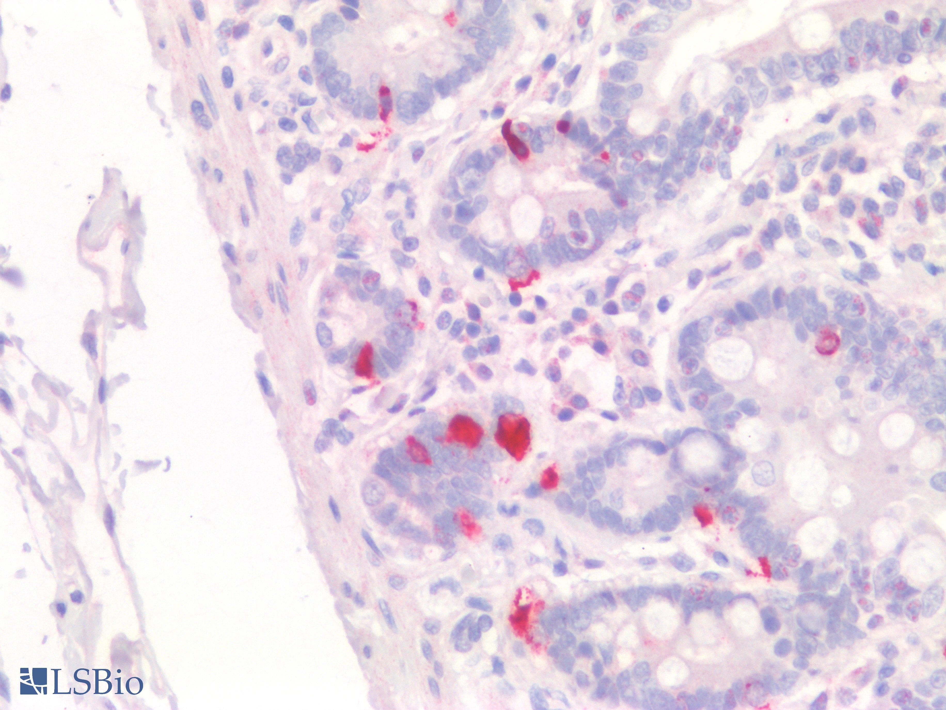 PathPlus™ CHGA / Chromogranin A Antibody