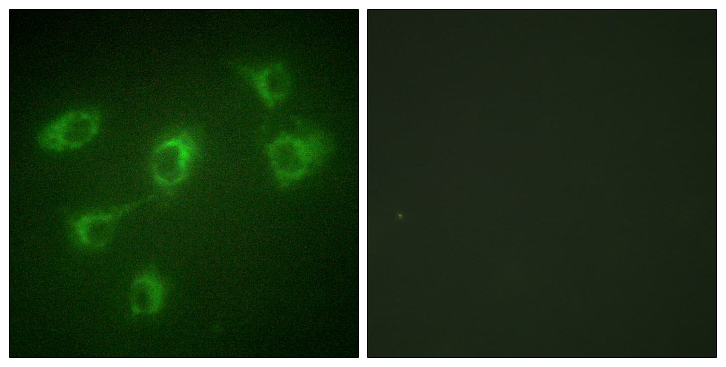 Betaglycan / TGFBR3 Antibody (aa111-160)