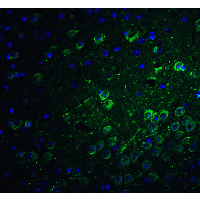 IHC-plus™ PACS1 Antibody