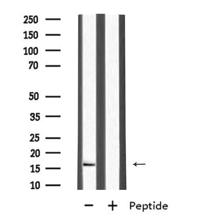 Polyclonal Rabbit anti-Human MRPL27 Antibody (WB)