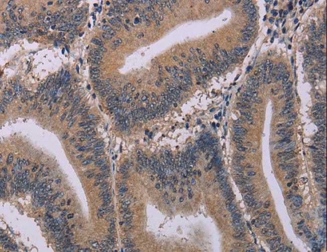 ACVR2 / ACVR2A Antibody
