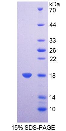 Mouse CBT1 / SDHD Protein (Recombinant His-T7)