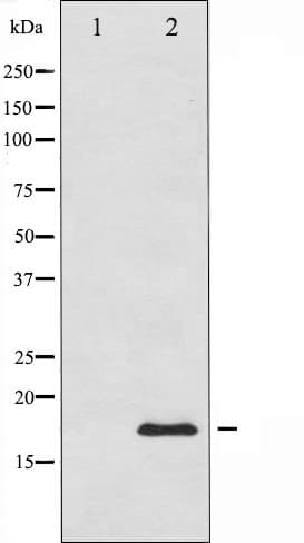 CALM3 / Calmodulin 3 Antibody