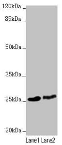 Polyclonal Rabbit anti-Human RNF114 / ZNF313 Antibody (IHC, WB)