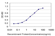 KCNJ10 / SESAME / KIR4.1 Antibody (clone 1C11)