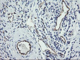 PECAM-1 / CD31 Antibody (clone OTI3H2)