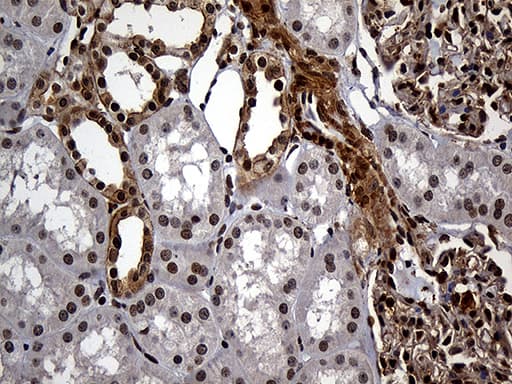 Monoclonal Mouse anti-Human RAD21 Antibody (clone OTI6C10, aa193-458, IHC, WB)