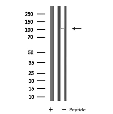 SP100 Antibody