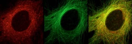 IHC-plus™ Polyclonal Rabbit anti-Human CKAP5 / ch-TOG Antibody (IHC, IF, WB)