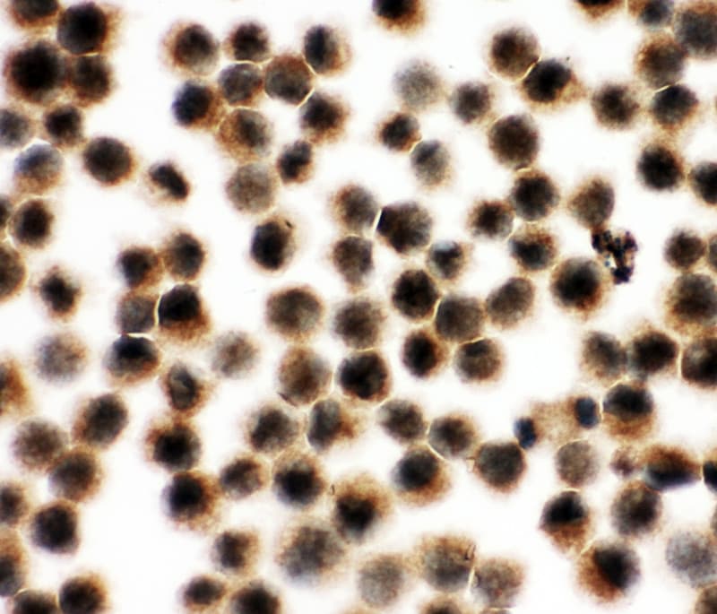 Polyclonal Rabbit anti-Human VCP Antibody (aa749-766, IHC, WB)