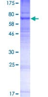 Human PIGV Protein (Recombinant GST)