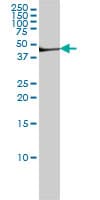 IHC-plus™ FGG / Fibrinogen Gamma Antibody (clone 1F2)