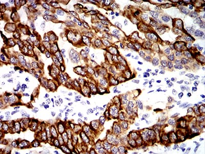 KRT19 / CK19 / Cytokeratin 19 Antibody (clone 8H1A8)