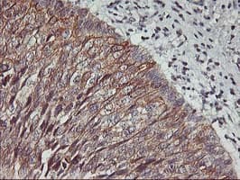 Monoclonal Mouse anti-Human PDSS2 / DLP1 Antibody (clone OTI1E9, IHC, IF, WB)
