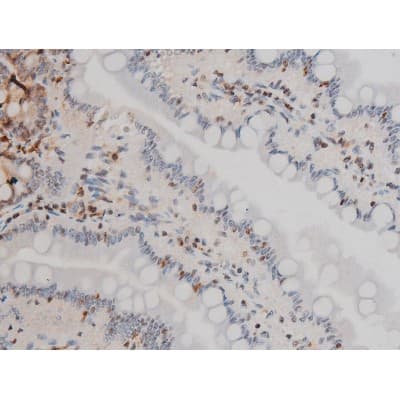 EZR / Ezrin Antibody (phospho-Tyr478)