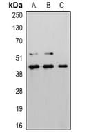 CASP8 / Caspase 8 Antibody