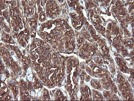 PDIA3 / ERp57 Antibody (aa140-505, clone OTI4D7)