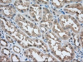 ACAT2 Antibody (clone OTI3C9)