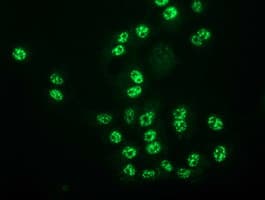 MGLL / Monoacylglycerol Lipase Antibody (clone OTI4D1)