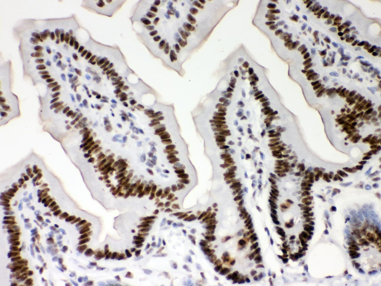 NPM1 / NPM / Nucleophosmin Antibody (aa1-294)