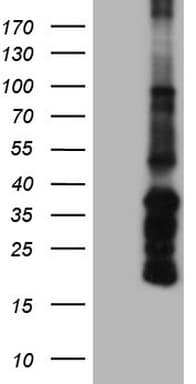 ANGPT1 / Angiopoietin-1 Antibody (aa198-498, clone OTI8H2)
