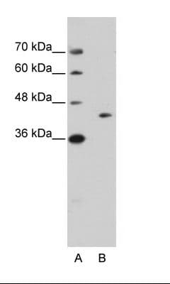 GIPC1 / GIPC Antibody (aa40-89)