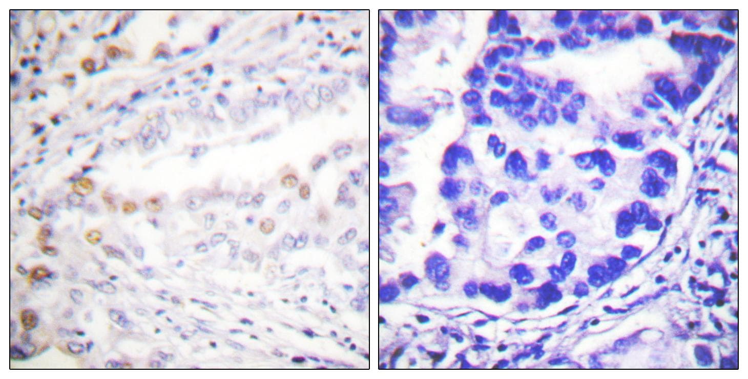 SAE2 / UBA2 Antibody