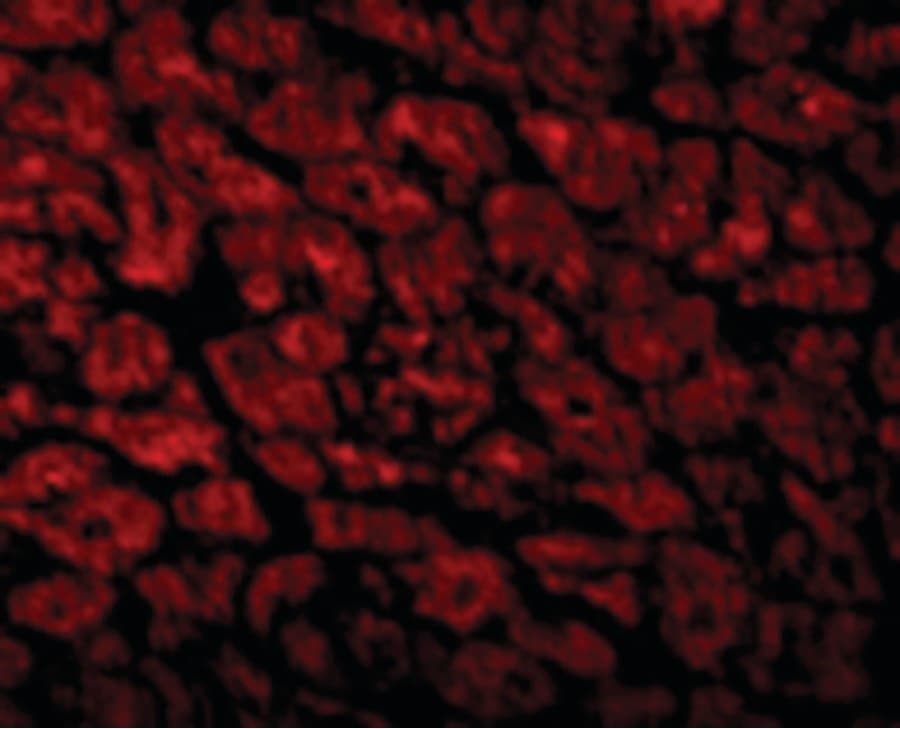 CX3CR1 Antibody