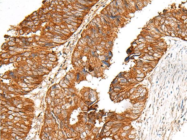 FKSG89 / MBOAT4 Antibody