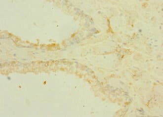 TRPM6 Antibody
