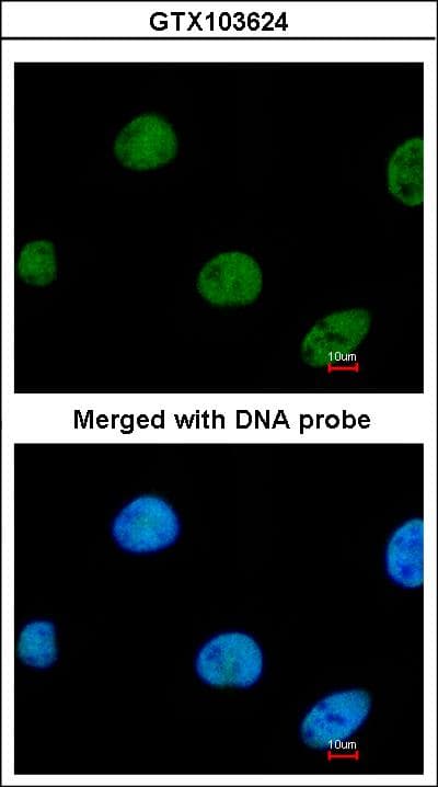 Polyclonal Rabbit anti-Human ZNF211 Antibody (aa190-453, WB)