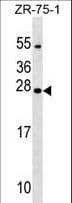NXNL1 / TXNL6 Antibody (aa94-121)